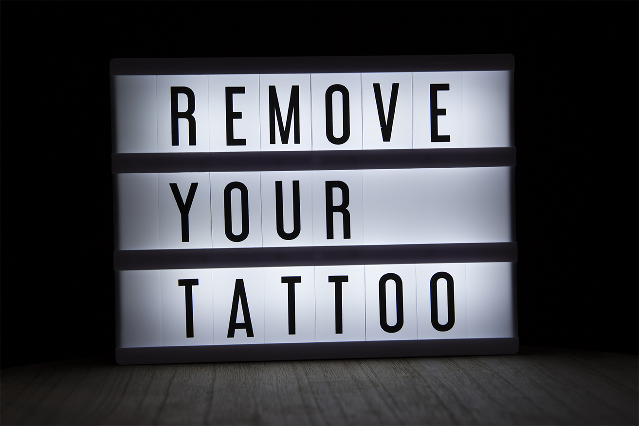 Remove Tattoo